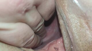 Stor fisse med dyb penetration